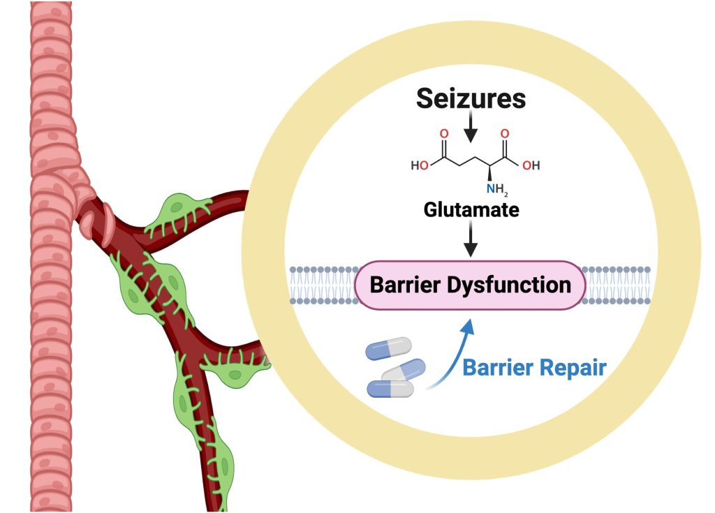 Epilepsy diagram